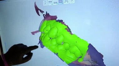 Diş hekimi, bir bilgisayar ekranındaki üç boyutlu diş modeline işaret ederek, potansiyel dişçilik alanlarını vurguluyor