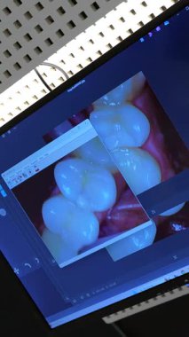 Diş sağlığı kliniği yazılımında gösterilen diş görüntülerini kapat, potansiyel olarak teşhis veya tedavi planlama için kullanılır.