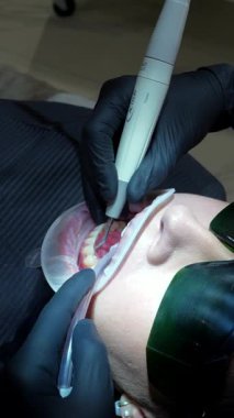 Diş hekimi diş hekiminde diş beyazlatma tedavisi için profesyonel ekipman kullanıyor.