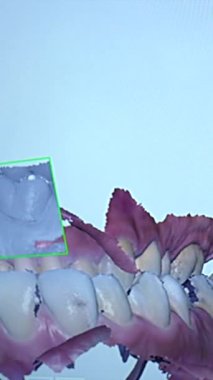 3D diş taramasını analiz eden yazılım modern bir diş sağlığı kliniğinde diş ve diş etlerini ön plana çıkarıyor, teşhis ve tedavi planlamasına yardımcı oluyor