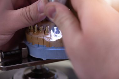 Dental technician works by brush with jaw model. Facial Dental Prosthetic