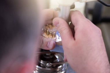 Dental technician works by brush with jaw model. Facial Dental Prosthetic