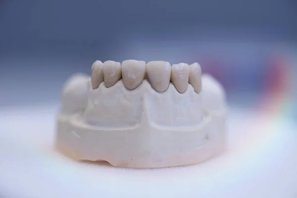 Close up tooth model / mock tooth in dental clinic Dental care and dentist 's equipment concept