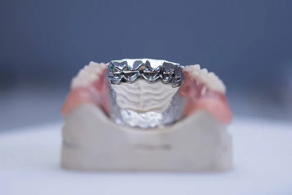 Close up tooth model / mock tooth in dental clinic Dental care and dentist \'s equipment concept