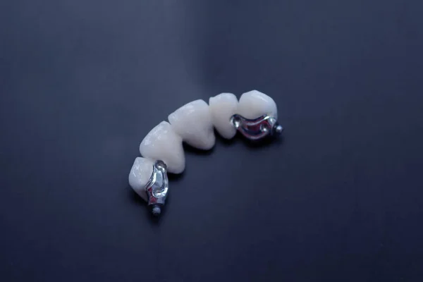 歯科診療所における歯モデル モック歯を閉じる歯科ケアと歯科医の機器コンセプト ロイヤリティフリーのストック画像