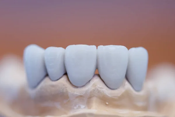 歯科診療所における歯モデル モック歯を閉じる歯科ケアと歯科医の機器コンセプト ストック画像