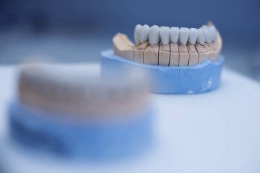 Diş hekimi mankeni. Bir ortodontik klinikte insan çenesi modelleri