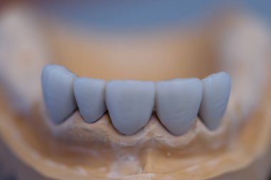 Diş hekimi mankeni. Bir ortodontik klinikte insan çenesi modelleri