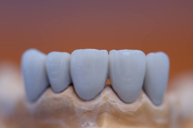 Diş hekimi mankeni. Bir ortodontik klinikte insan çenesi modelleri