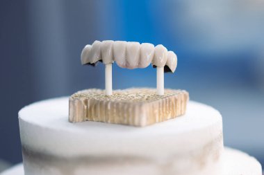 Diş hekimi mankeni. Bir ortodontik klinikte insan çenesi modelleri