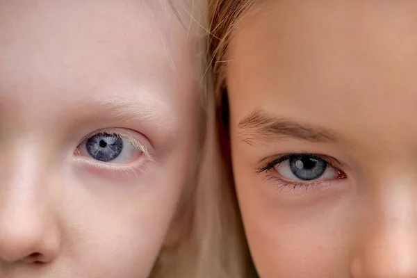 Olhos Azuis Verdes Incomuns Fechar Foto Recortada Dois Amigos Com — Fotografia de Stock