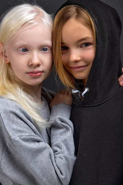 Migliori Amici Sostengono Vicenda Albino Con Insoliti Occhi Blu Abbracciare — Foto Stock