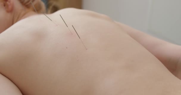 認知できない男性マッサージャーが背中の脊髄炎の治療を クリニック病院でリハビリのためにしています 女性の体に焦点を当てる 健康的なライフスタイルのスローモーション — ストック動画