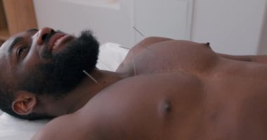 Genç adam klinikte yavaş çekimde iğne tedavisi görüyor. Acısız ve etkili bir işlem. Korku olmadan, Afrikalı Amerikalı hasta akupunktur deniyor.