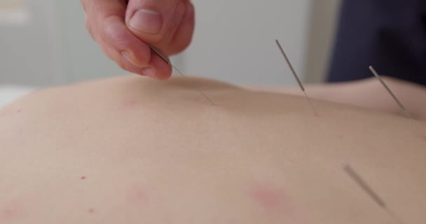 Close Vídeo Mans Hands Taking Needle Out Female Skin Movimento — Vídeo de Stock