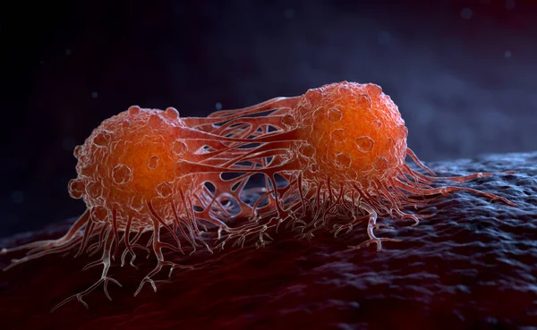 Kanser Hücreleri Diğer Vücut Dokularına Organlarına Göç Ederek Metastaz Yapabilirler — Stok fotoğraf