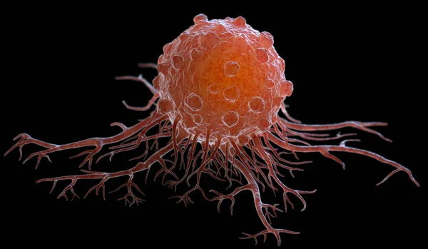Las Células Cancerosas Pueden Migrar Otros Tejidos Órganos Corporales Que — Foto de Stock