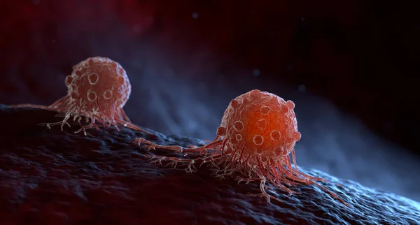 癌細胞は転移を造る他のボディ組織か器官に移行できる 3Dイラスト — ストック写真