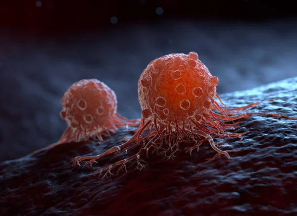 Раковые Клетки Могут Мигрировать Другие Ткани Органы Создающие Метастазы Иллюстрация — стоковое фото