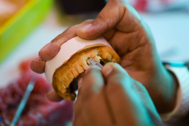 Protez diş işçiliğini kapatıyoruz. Diş protezi oluşturmanın detaylı çalışmalarını gösteriyoruz.