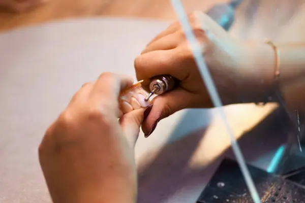 Close Prosthetic Dental Craftsmanship Showcasing Detailed Work Creating Dental Prosthesis — Stock Photo, Image
