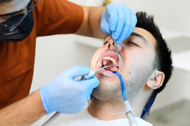 Uzman diş beyazlatma prosedürü devam ediyor