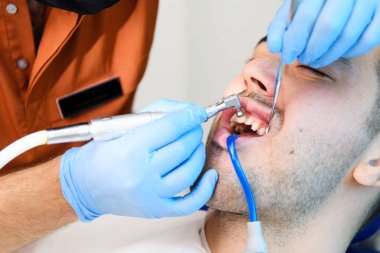 Uzman diş beyazlatma prosedürü devam ediyor