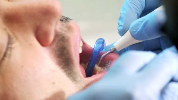 Vídeo Cámara Lenta Primer Plano Que Muestra Procedimiento Enjuague Dental — Vídeos de Stock