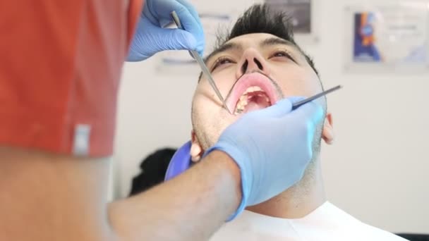 Nahaufnahme Der Zahnärztlichen Untersuchung Eines Männlichen Patienten — Stockvideo