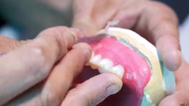 Высокая Точность Протезирования Зубов Крупный План Изготовления Протезов — стоковое видео