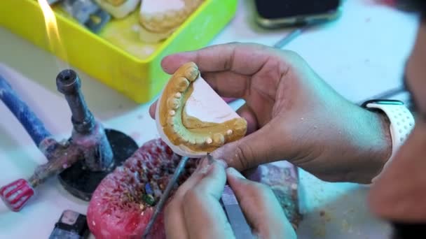 假牙的植入精度 假牙制造的近视 — 图库视频影像