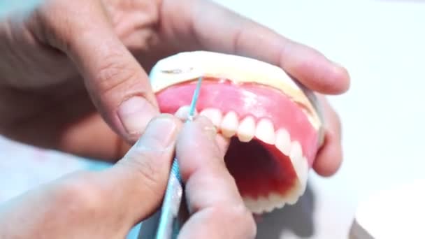 假牙的植入精度 假牙制造的近视 — 图库视频影像