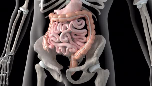 Video Overview Intestinal Diverticula — Stock Video