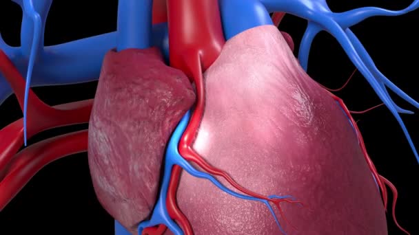 Esta Animação Mostra Único Bypass Cardíaco — Vídeo de Stock