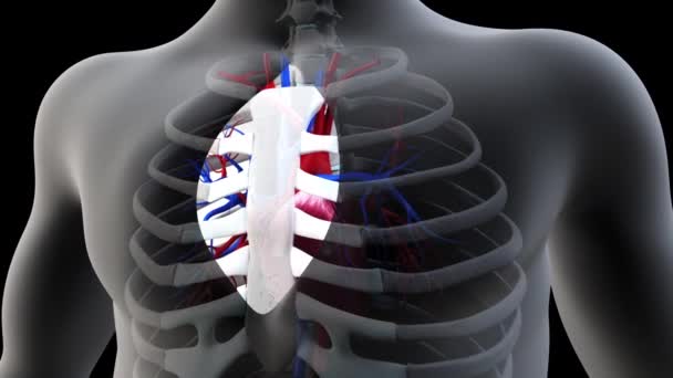 この3Dアニメーションは心臓バイパス手術を示しています — ストック動画