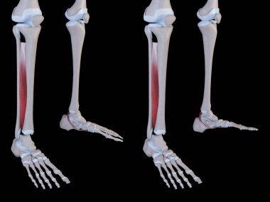 Bu 3 boyutlu çizim tibialis posterior kas hareketini gösteriyor.