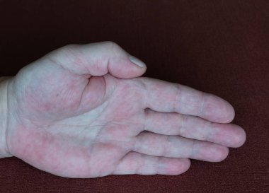 Yaşlı bir adamın avucunun içi koyu renk kumaşın arka planında.