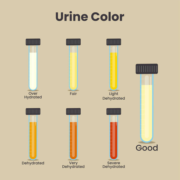 Urine color in test tubes vector illustration