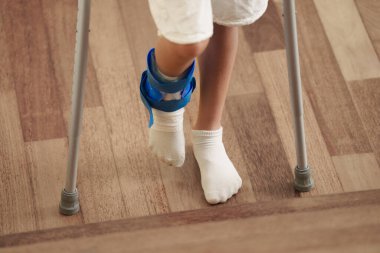 Koltuk değnekli yaralı bir çocuk. Çocuk yaya ve bacağı alçıda. Bileği burkulmuş küçük çocuk tekrar yürümeyi öğreniyor. Sağlık kliniğinde fizik tedavi. Ortopedik travma tedavisi. Doktor genç hastaya yardım ediyor