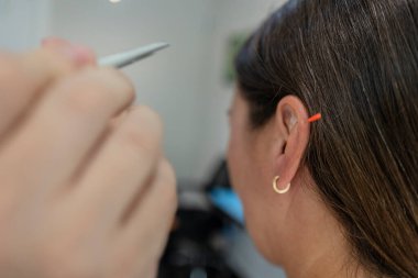 Bir kadın kulağına akupunktur terapisi yaptırıyor, bir pratisyen el kulağına yakın bir aletle alternatif tıp ve bütünsel sağlık kavramlarını vurguluyor.