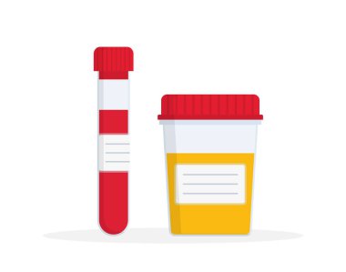 Urine and blood test for analysis. Samples in tube and container for laboratory. Examination of health in hospital. Medical diagnostics of disease, pregnancy and doping. Control of healthy. Vector.