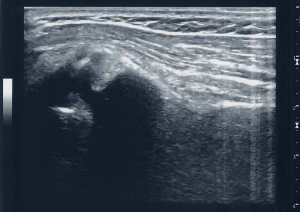 Ultrasonido Muscular Del Tendón Médico También Conocido Como Ultrasonografía —  Fotos de Stock