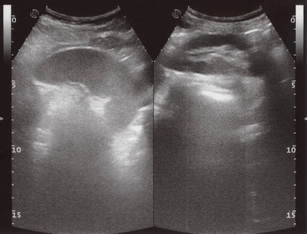 Full Abdomen Ultrasound Image Aka Diagnostic Sonogram — Stock Photo, Image