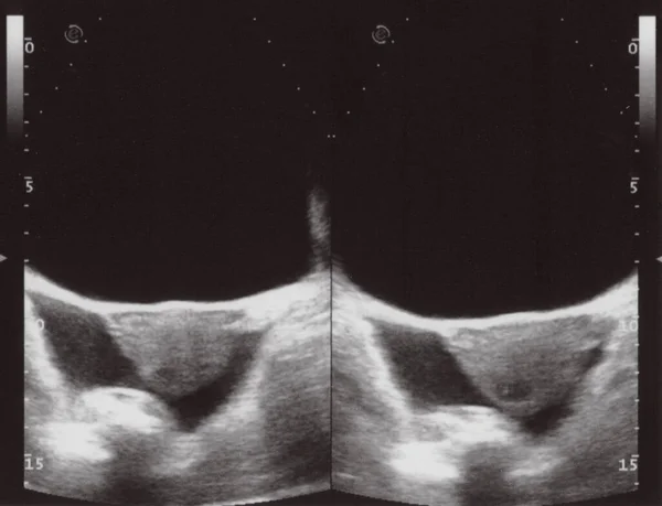 Full Abdomen Ultrasound Image Aka Diagnostic Sonogram — Zdjęcie stockowe