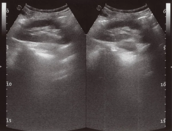 Full Abdomen Ultrasound Image Aka Diagnostic Sonogram — 스톡 사진