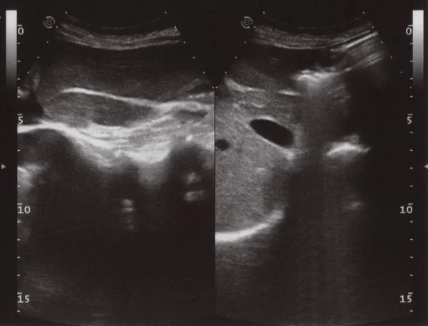 Full Abdomen Ultrasound Image Aka Diagnostic Sonogram — 图库照片