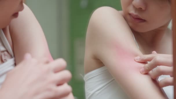 Проблеми Шкірою Краса Молодої Жінки Подряпині Алергія Шкірі Стероїди Чутлива — стокове відео