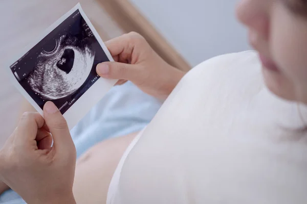 stock image pregnant woman is looking at an ultrasound photo of fetus. Mother gently touches the baby on stomach. Happy, family, growth, pregnancy, enjoyment , prepare newborn, take care, healthcare, tummy.