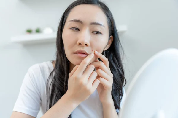 Wanita Muda Khawatir Tentang Wajah Dermatologi Dan Alergi Terhadap Steroid — Stok Foto