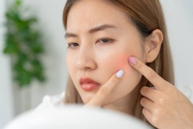 Genç Asyalı kadın, yüz dermatolojisi ve kozmetik ürünlerinde steroidlere alerjisi olduğu için endişeli. Hassas cilt, güneş yanığı, sivilce, kimyasallara alerjisi, yüzünde kızarıklık. cilt sorunları ve güzellik